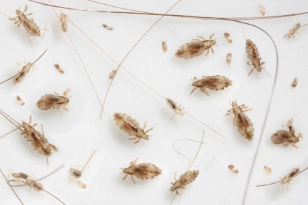 How to Spot Head Lice and What to Do Next