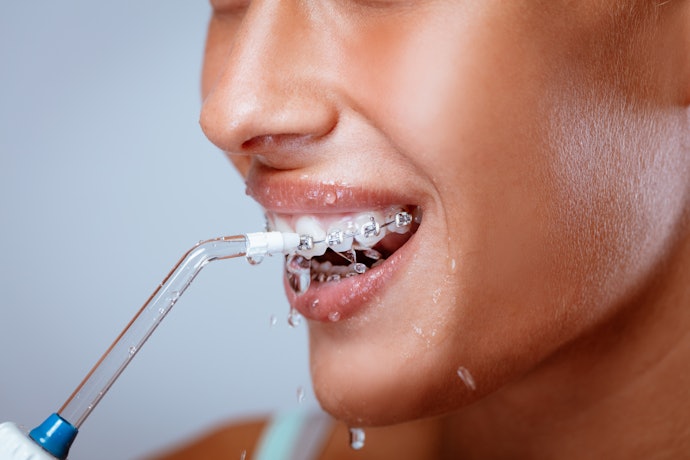Benefits of a Water Flosser