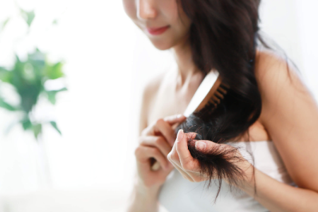 What Causes Hair Loss?