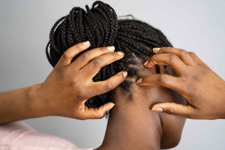 Determine if You Have a Dry or Oily Scalp: Dry Scalps Are Itchy and Flaky, Oily Scalps Become Greasy a Day After Washing