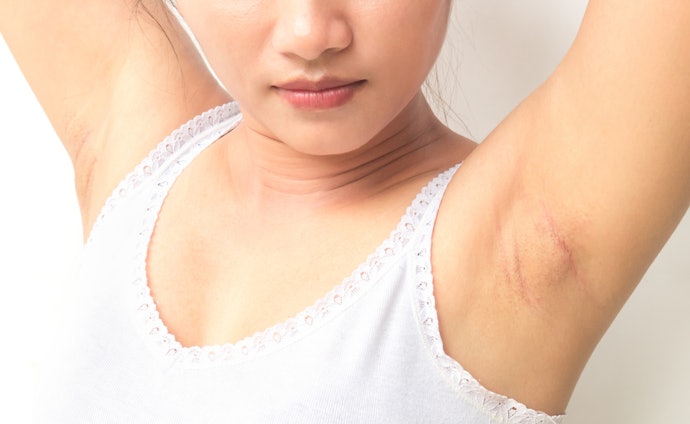 Look For Alcohol and Aluminium-Free Deodorants if You Want to Minimise Potential Health Risks and Avoid Dry Underarm Skin