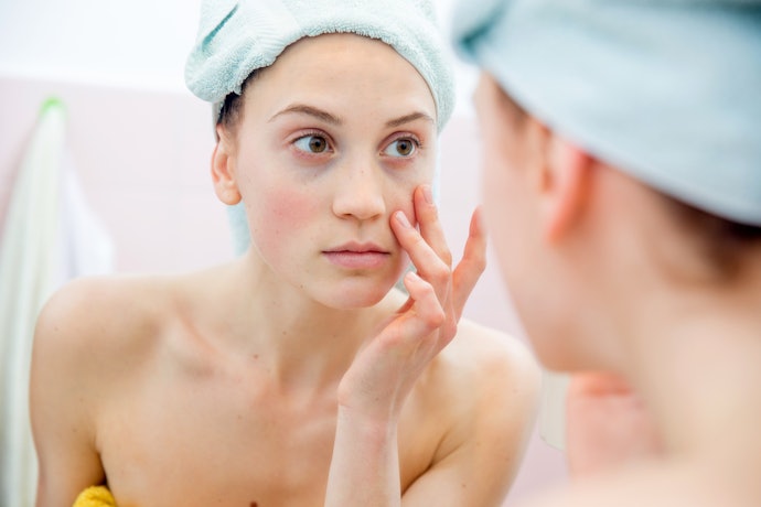 Are There Other Concerns Like Dark Circles and Puffiness?