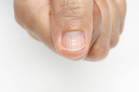 Opt For a Conditioning Base Coat to Fill In Ridges and Create a Smooth Surface for Polish
