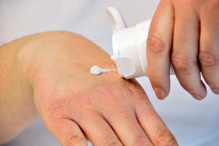Sensitive and Irritated Hands Need Soothing Ingredients
