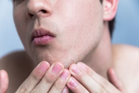 Guys With Sensitive Skin Should Seek Dermatologically-Tested Products