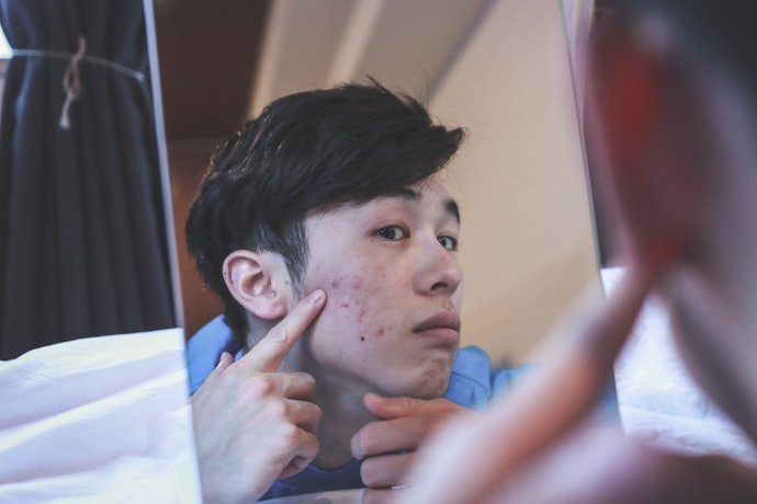 People With Oily Skin Should Stay Away from Alcohol-Based Products and Perfumes