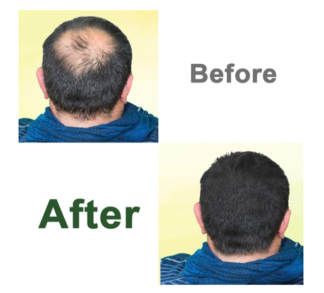 Growth Serum 2